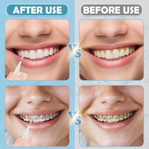 120 Pieces Braces Dental Brush Flosser for Cleaner Interdental Brushes Between Teeth with Soft Bristles 360° Bendable Toothpick Dental Tooth Floss...